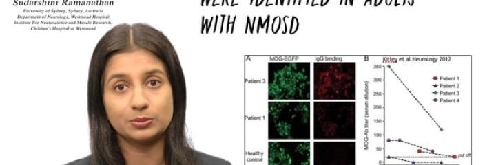 #MS Talks Episode 18: MOG antibody-associated demyelination